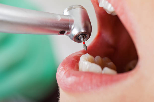 Best Weekend Emergency Dentist in Shelbyville, IN
